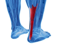 Ways the Achilles Tendon Can Be Injured