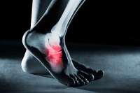 How Do Stress Fractures Occur?