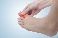 High Uric Acid Levels and Gout