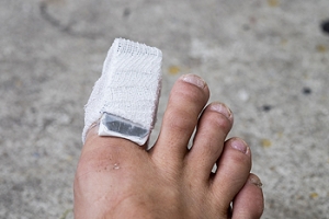 Different Types of Toe Fractures