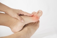 What to Consider Before Bunion Surgery