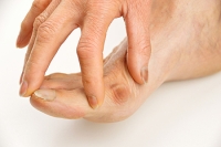 Wearing Tight Shoes May Cause Bunions